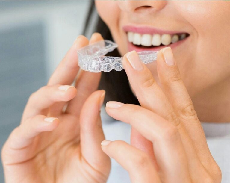 Alineadores invisibles Invisalign