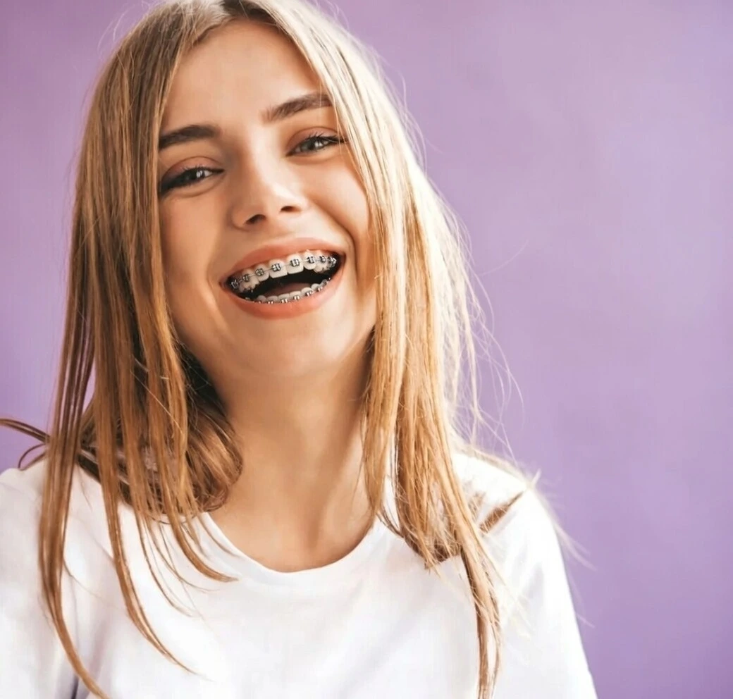 Sonrisa con brackets