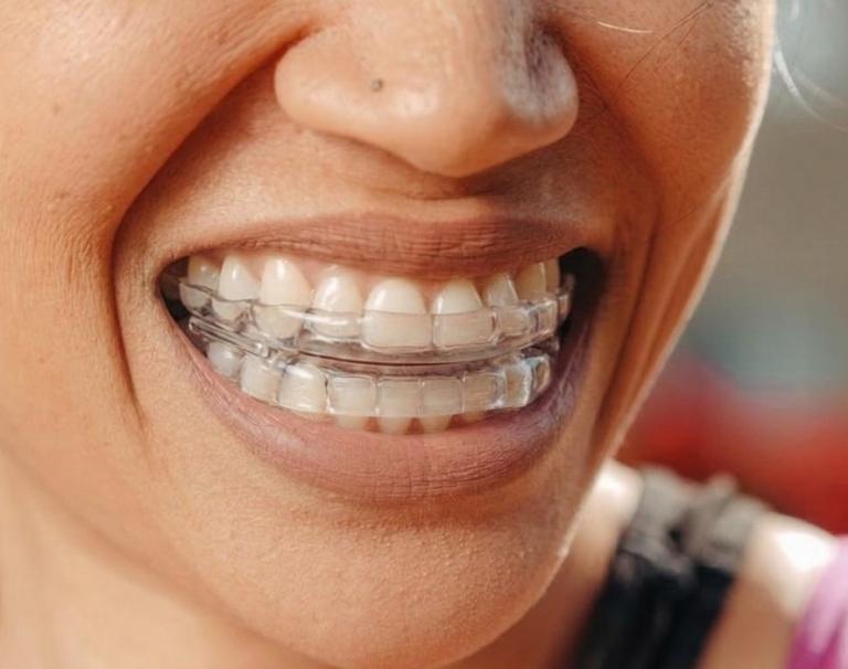 dispositivo de avance mandibular